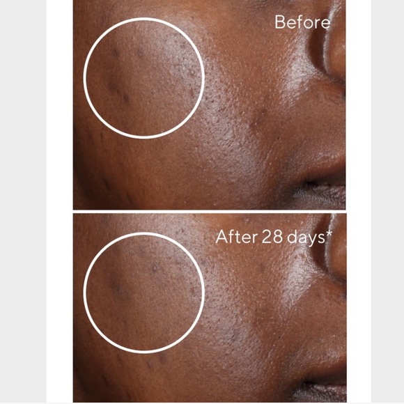 😊 NIB Murad Environmenral Sheild Rapid Dark Spot Correcting Serum 0.17 fl oz 😊 - Picture 4 of 7